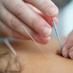 Medical Acupuncture Clinic In Melbourne